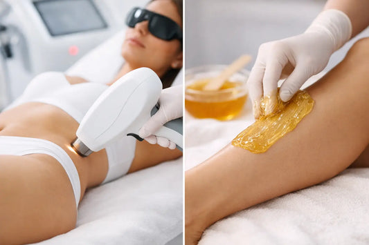 Laserkarvanpoisto vai sokerointi ihokarvoille?