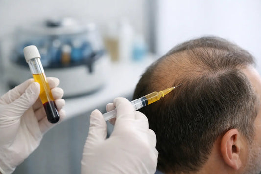 Miten PRP auttaa hiustenlähtöön?