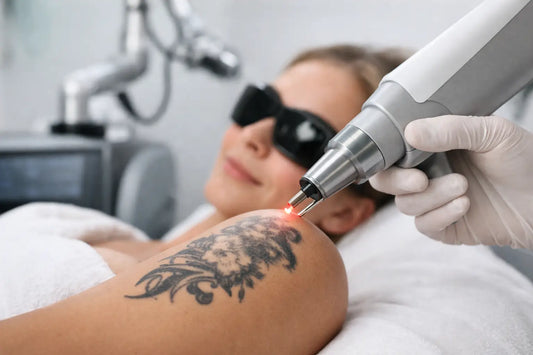Laser tatuoinnin poisto - kokemuksia ja faktat
